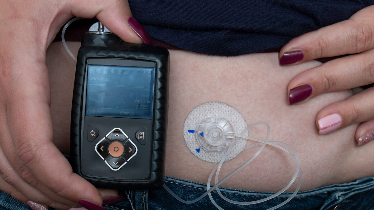 ‘Life-changing’ diabetes technology to be made more widely available after cash boost